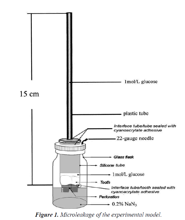 biomedical-pharmaceutical-sciences-Microleakage